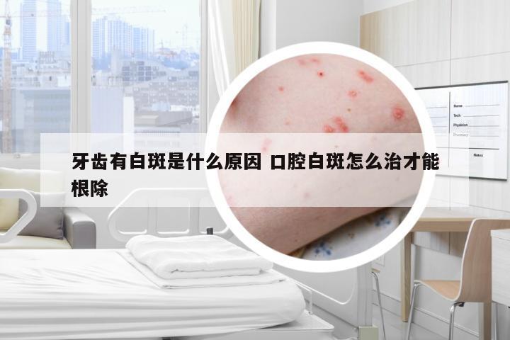 牙齿有白斑是什么原因 口腔白斑怎么治才能根除