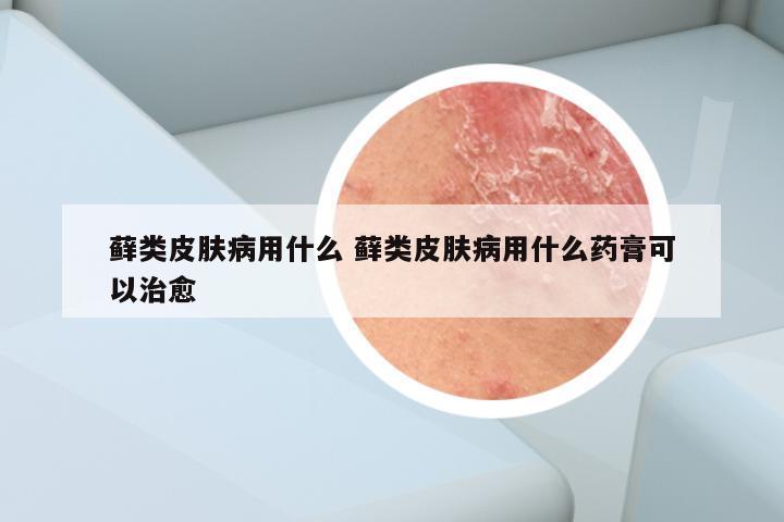 藓类皮肤病用什么 藓类皮肤病用什么药膏可以治愈