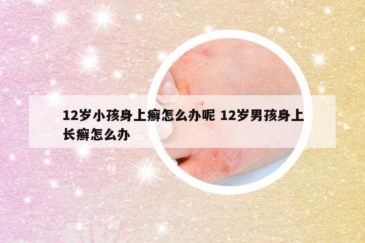 12岁小孩身上癣怎么办呢 12岁男孩身上长癣怎么办