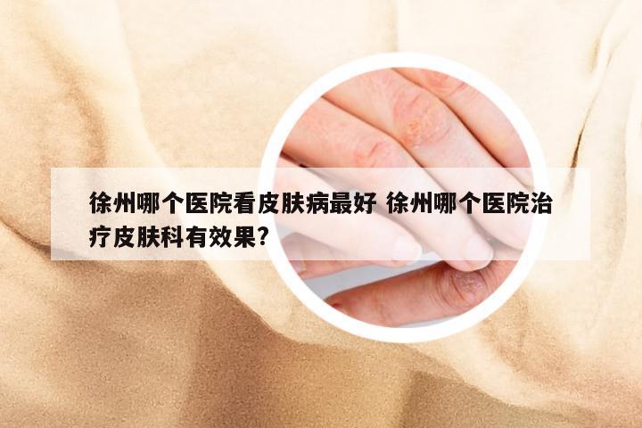 徐州哪个医院看皮肤病最好 徐州哪个医院治疗皮肤科有效果?