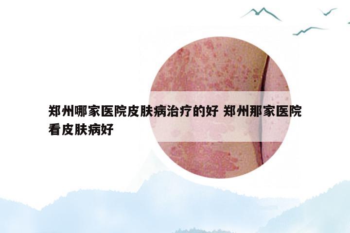 郑州哪家医院皮肤病治疗的好 郑州那家医院看皮肤病好