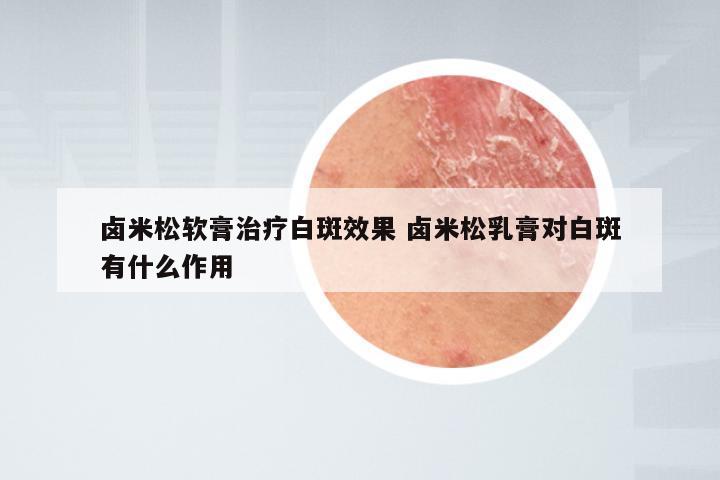 卤米松软膏治疗白斑效果 卤米松乳膏对白斑有什么作用