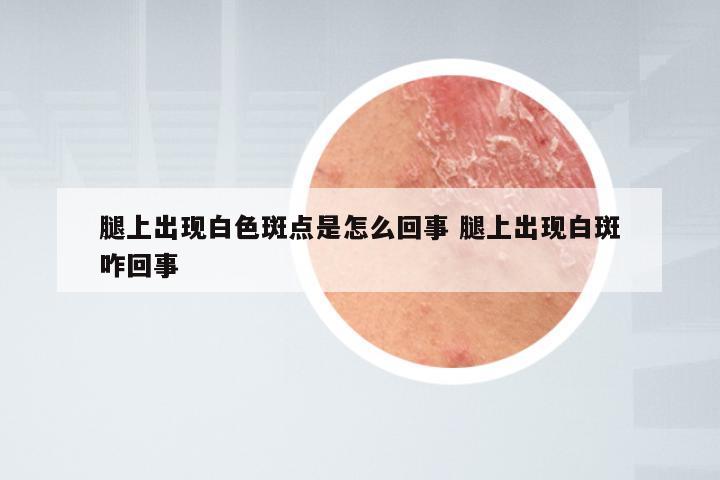 腿上出现白色斑点是怎么回事 腿上出现白斑咋回事