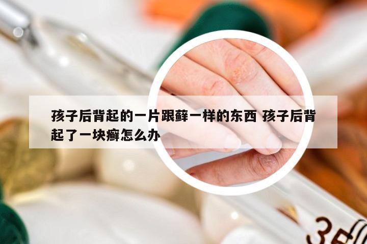 孩子后背起的一片跟藓一样的东西 孩子后背起了一块癣怎么办