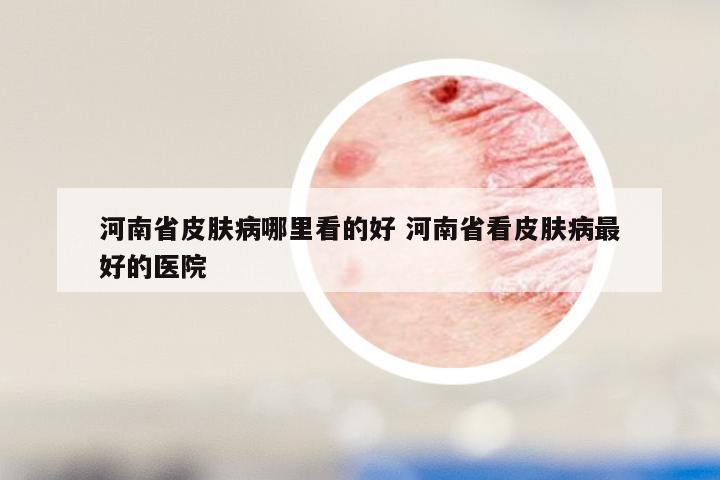 河南省皮肤病哪里看的好 河南省看皮肤病最好的医院