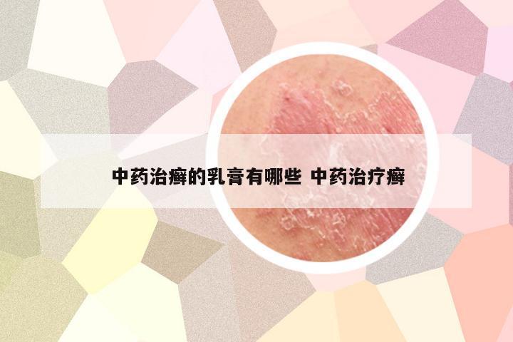 中药治癣的乳膏有哪些 中药治疗癣