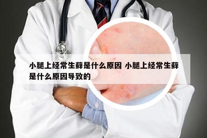 小腿上经常生藓是什么原因 小腿上经常生藓是什么原因导致的