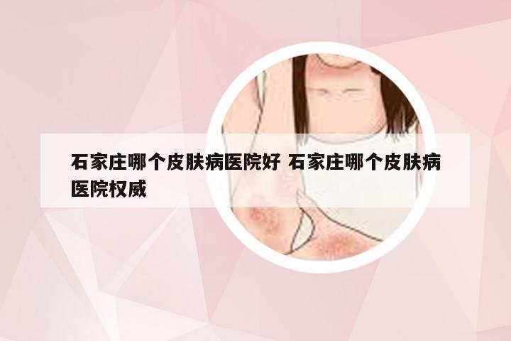 石家庄哪个皮肤病医院好 石家庄哪个皮肤病医院权威