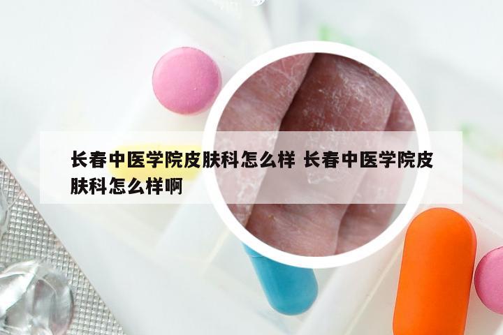 长春中医学院皮肤科怎么样 长春中医学院皮肤科怎么样啊