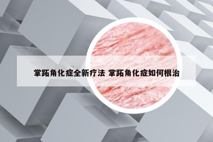 掌跖角化症全新疗法 掌跖角化症如何根治