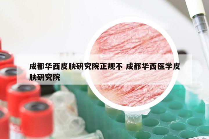 成都华西皮肤研究院正规不 成都华西医学皮肤研究院