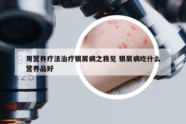 用营养疗法治疗银屑病之我见 银屑病吃什么营养品好