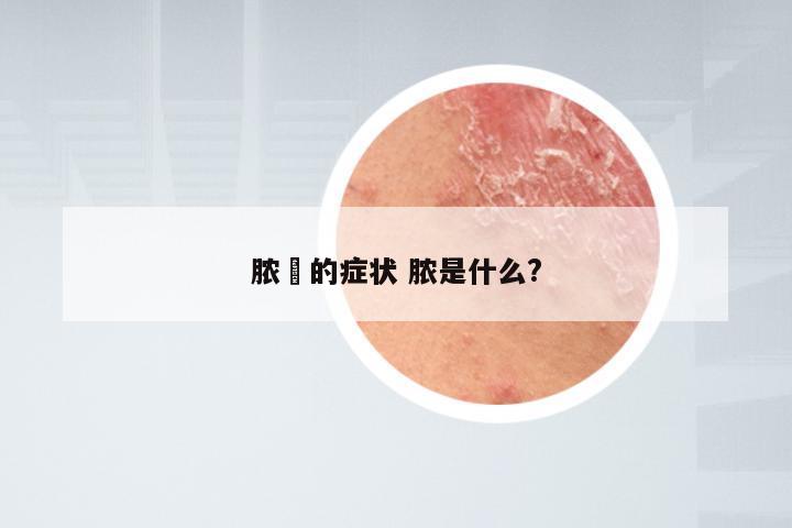 脓廯的症状 脓是什么?