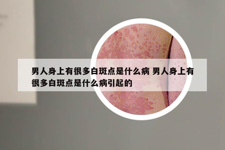 男人身上有很多白斑点是什么病 男人身上有很多白斑点是什么病引起的