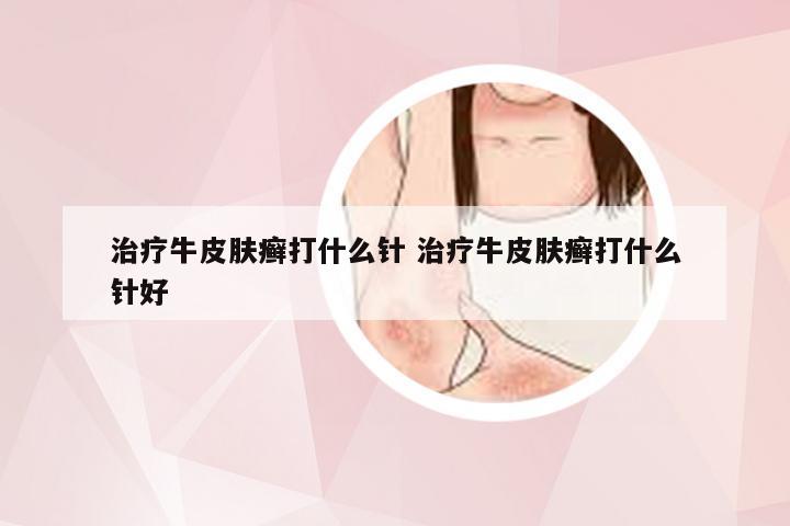 治疗牛皮肤癣打什么针 治疗牛皮肤癣打什么针好