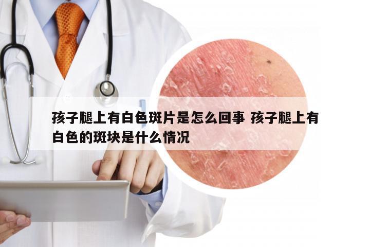 孩子腿上有白色斑片是怎么回事 孩子腿上有白色的斑块是什么情况