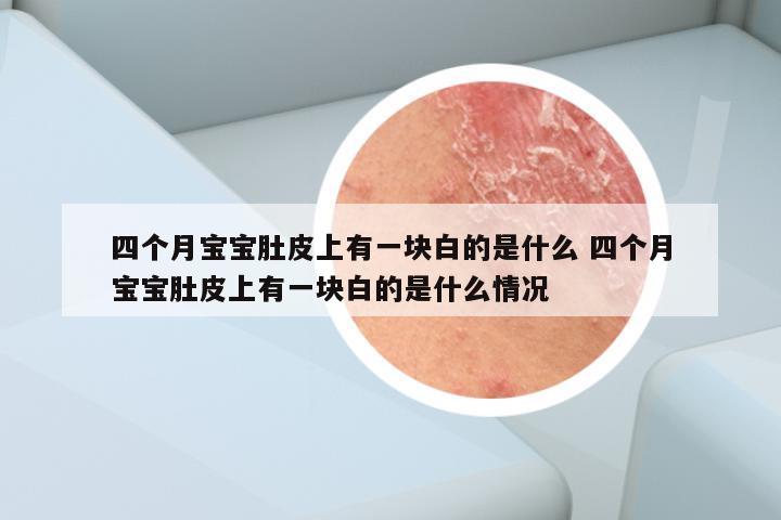 四个月宝宝肚皮上有一块白的是什么 四个月宝宝肚皮上有一块白的是什么情况