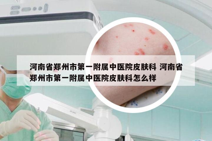 河南省郑州市第一附属中医院皮肤科 河南省郑州市第一附属中医院皮肤科怎么样