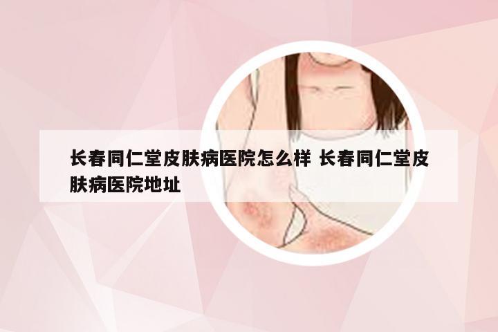 长春同仁堂皮肤病医院怎么样 长春同仁堂皮肤病医院地址