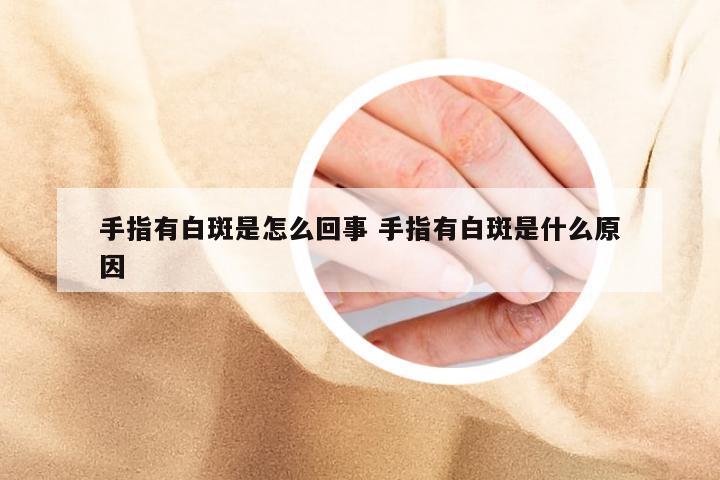 手指有白斑是怎么回事 手指有白斑是什么原因