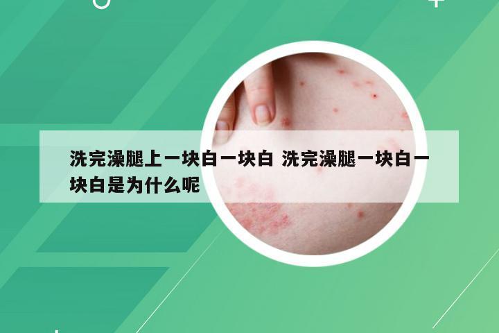 洗完澡腿上一块白一块白 洗完澡腿一块白一块白是为什么呢