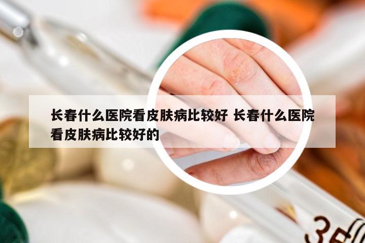 长春什么医院看皮肤病比较好 长春什么医院看皮肤病比较好的