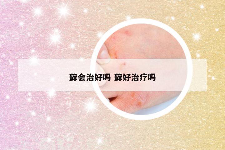 藓会治好吗 藓好治疗吗