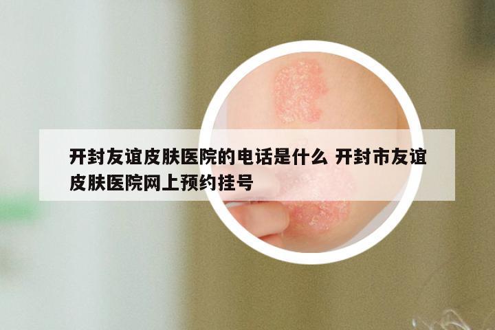 开封友谊皮肤医院的电话是什么 开封市友谊皮肤医院网上预约挂号