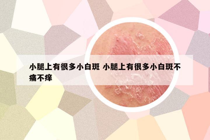 小腿上有很多小白斑 小腿上有很多小白斑不痛不痒