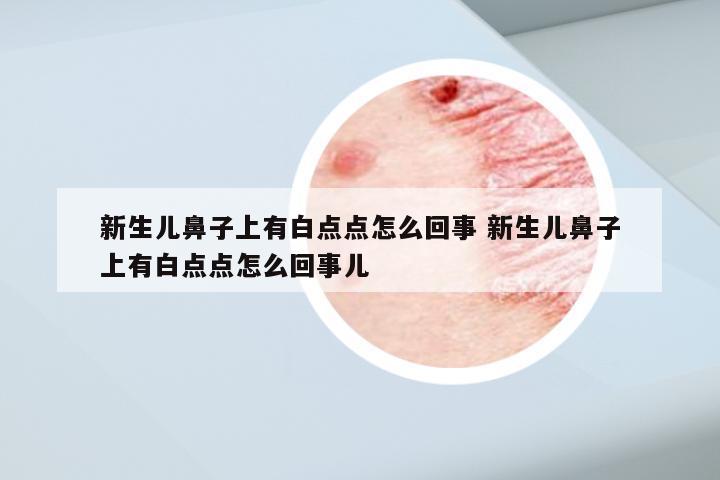 新生儿鼻子上有白点点怎么回事 新生儿鼻子上有白点点怎么回事儿