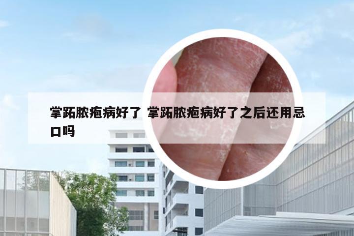 掌跖脓疱病好了 掌跖脓疱病好了之后还用忌口吗