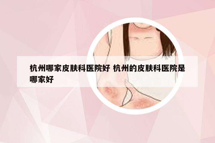 杭州哪家皮肤科医院好 杭州的皮肤科医院是哪家好