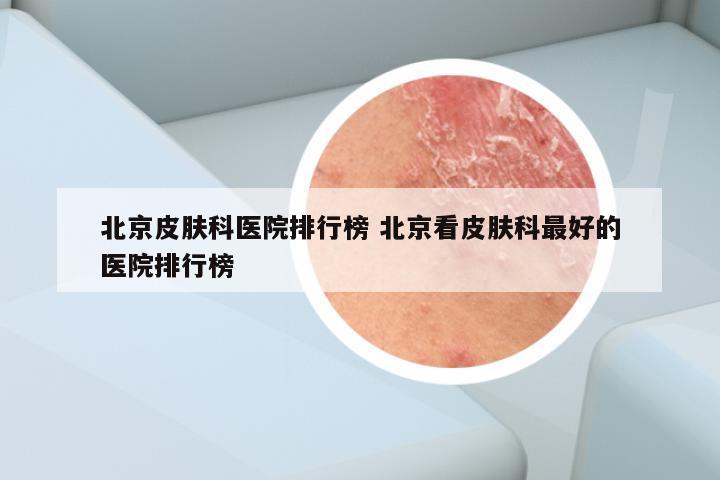 北京皮肤科医院排行榜 北京看皮肤科最好的医院排行榜