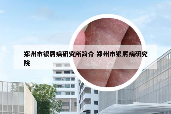 郑州市银屑病研究所简介 郑州市银屑病研究院