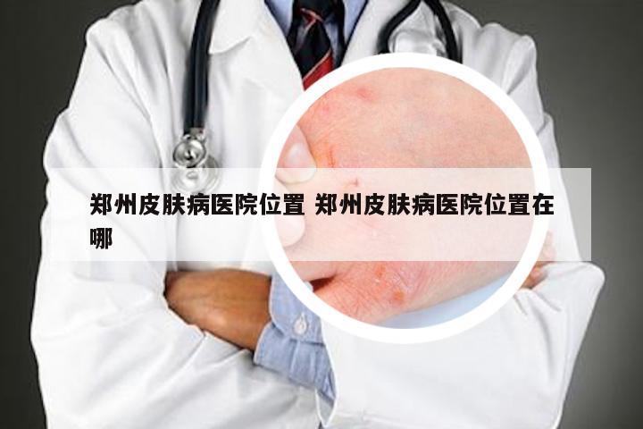 郑州皮肤病医院位置 郑州皮肤病医院位置在哪