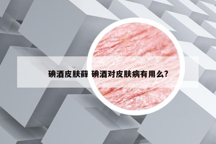 碘酒皮肤藓 碘酒对皮肤病有用么?