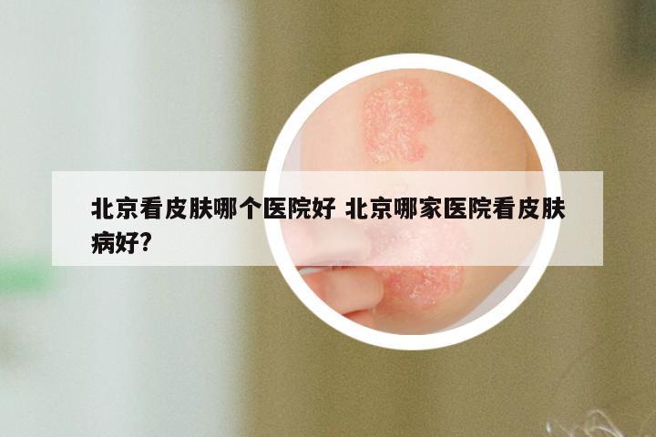 北京看皮肤哪个医院好 北京哪家医院看皮肤病好?