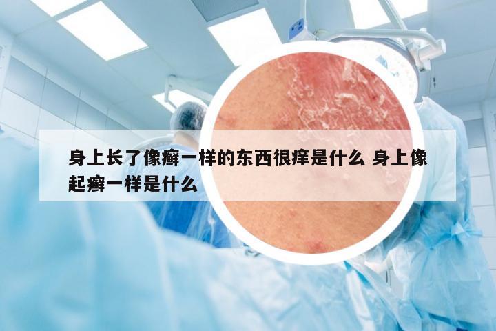 身上长了像癣一样的东西很痒是什么 身上像起癣一样是什么