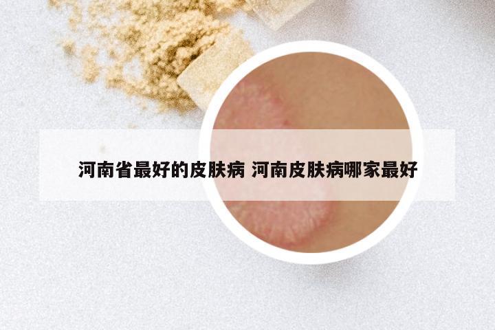 河南省最好的皮肤病 河南皮肤病哪家最好