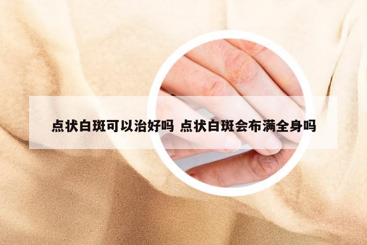 点状白斑可以治好吗 点状白斑会布满全身吗