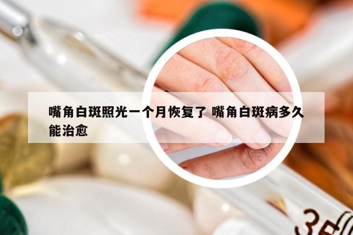 嘴角白斑照光一个月恢复了 嘴角白斑病多久能治愈