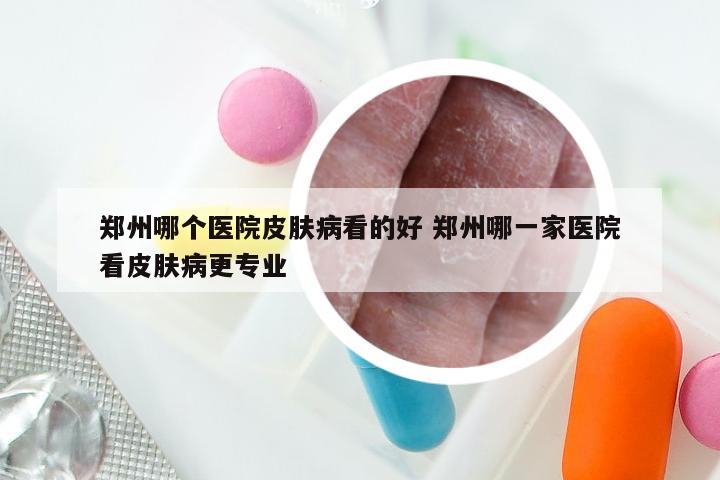 郑州哪个医院皮肤病看的好 郑州哪一家医院看皮肤病更专业