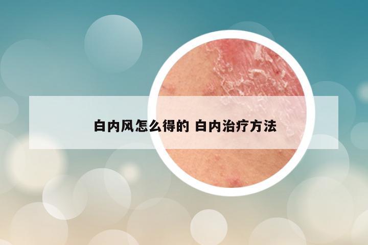 白内风怎么得的 白内治疗方法