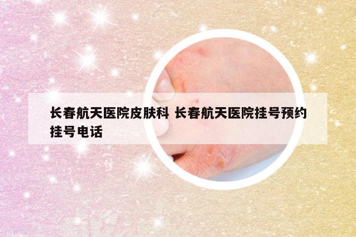 长春航天医院皮肤科 长春航天医院挂号预约挂号电话