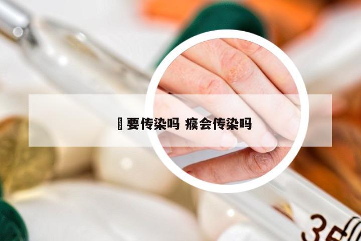 廯要传染吗 瘊会传染吗