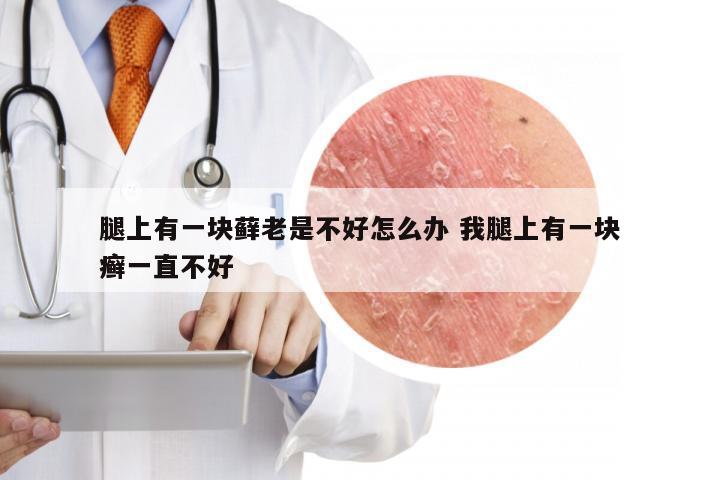 腿上有一块藓老是不好怎么办 我腿上有一块癣一直不好