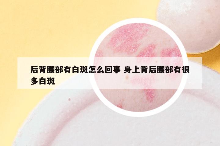 后背腰部有白斑怎么回事 身上背后腰部有很多白斑