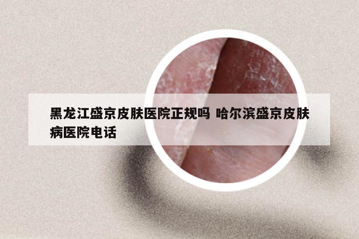 黑龙江盛京皮肤医院正规吗 哈尔滨盛京皮肤病医院电话