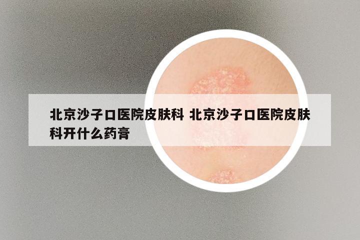 北京沙子口医院皮肤科 北京沙子口医院皮肤科开什么药膏