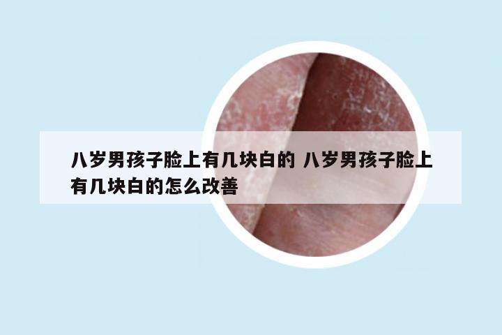 八岁男孩子脸上有几块白的 八岁男孩子脸上有几块白的怎么改善